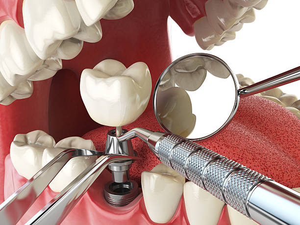 Best Knocked-Out Tooth Emergency  in Raubsville, PA